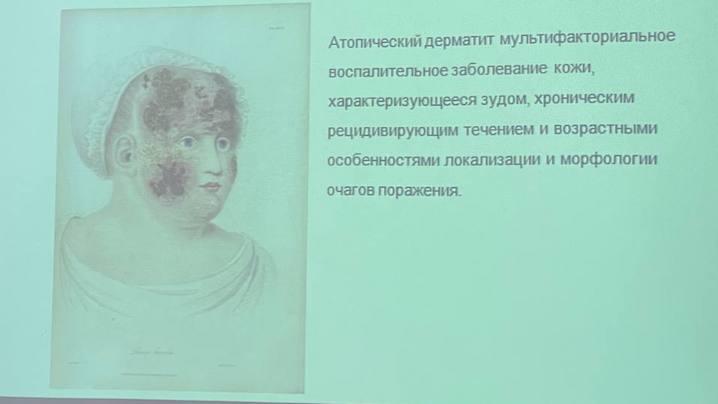 Пациенты со сложными формами псориаза получили консультации у ведущих специалистов страны в Мурманске